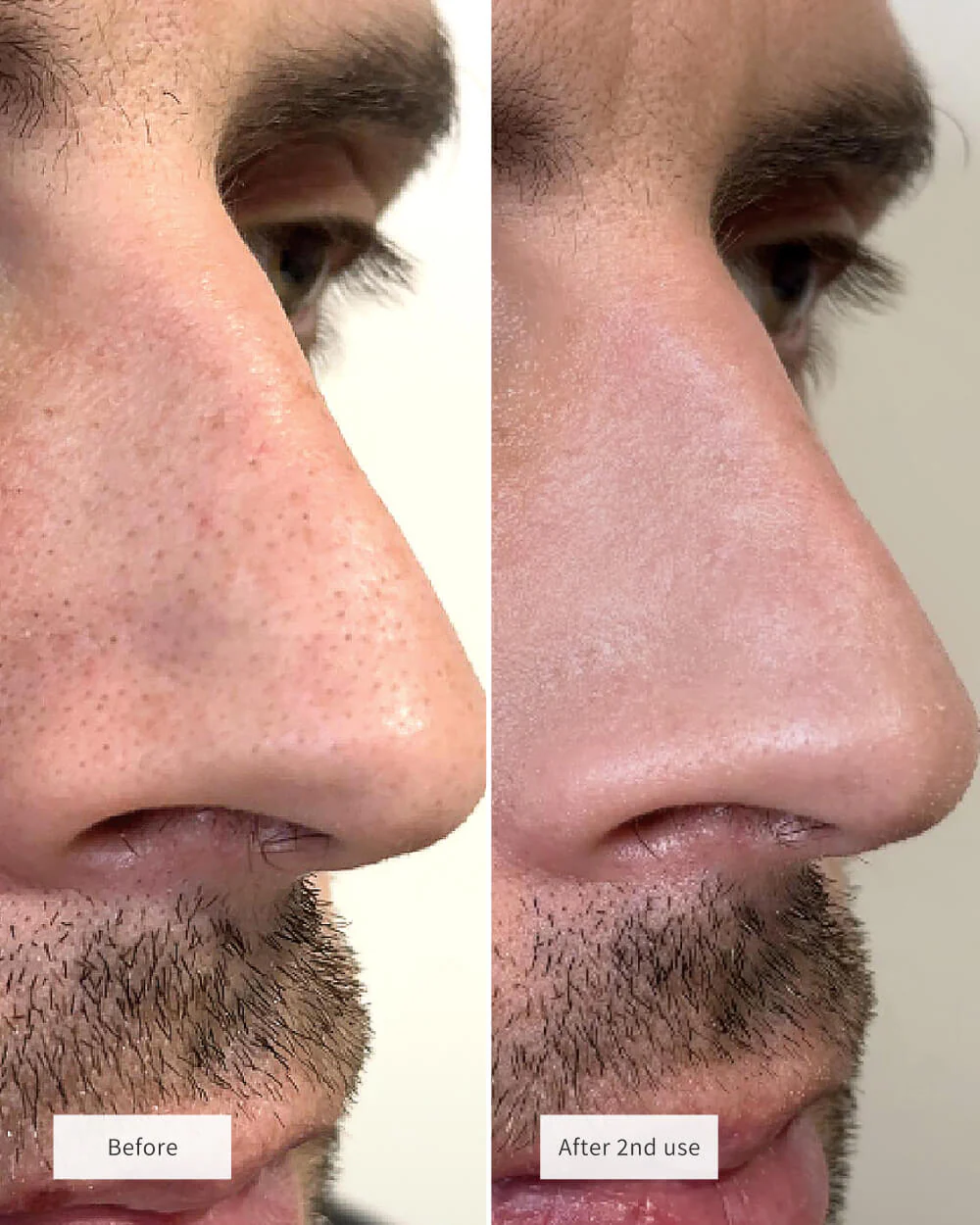 CLEAR PORE DUO - Image 3