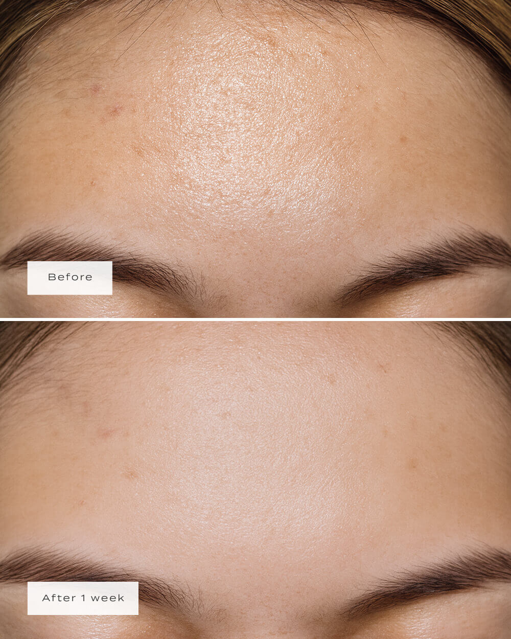 FOREHEAD PATCHES - Image 4