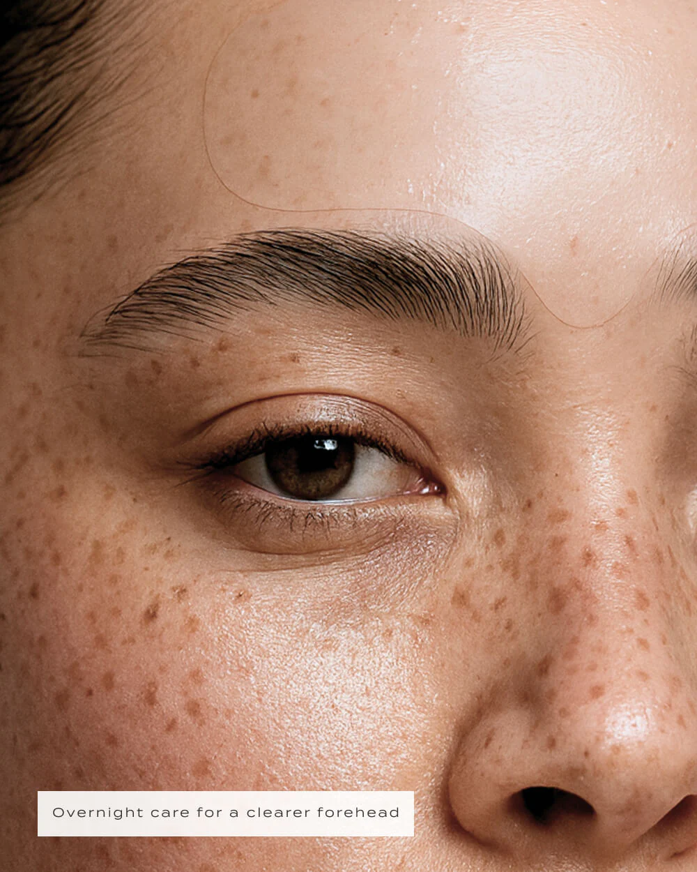 FOREHEAD PATCHES - Image 6