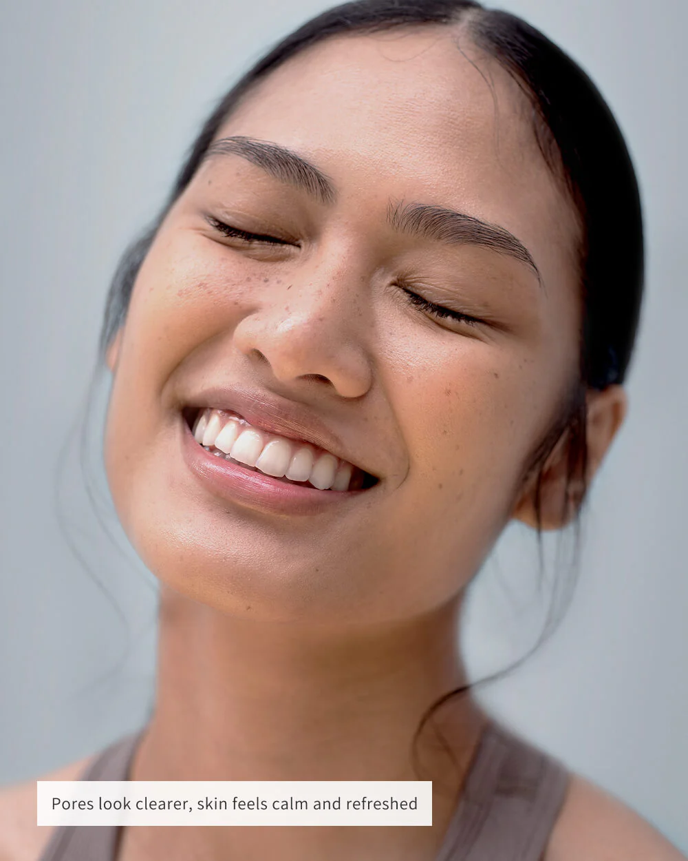 NOSE PATCHES - Image 10