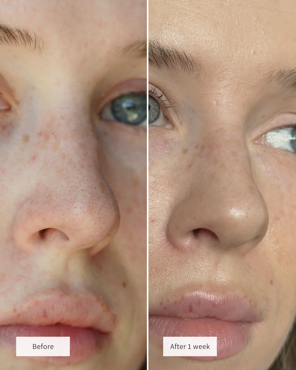 NOSE PATCHES - Image 3