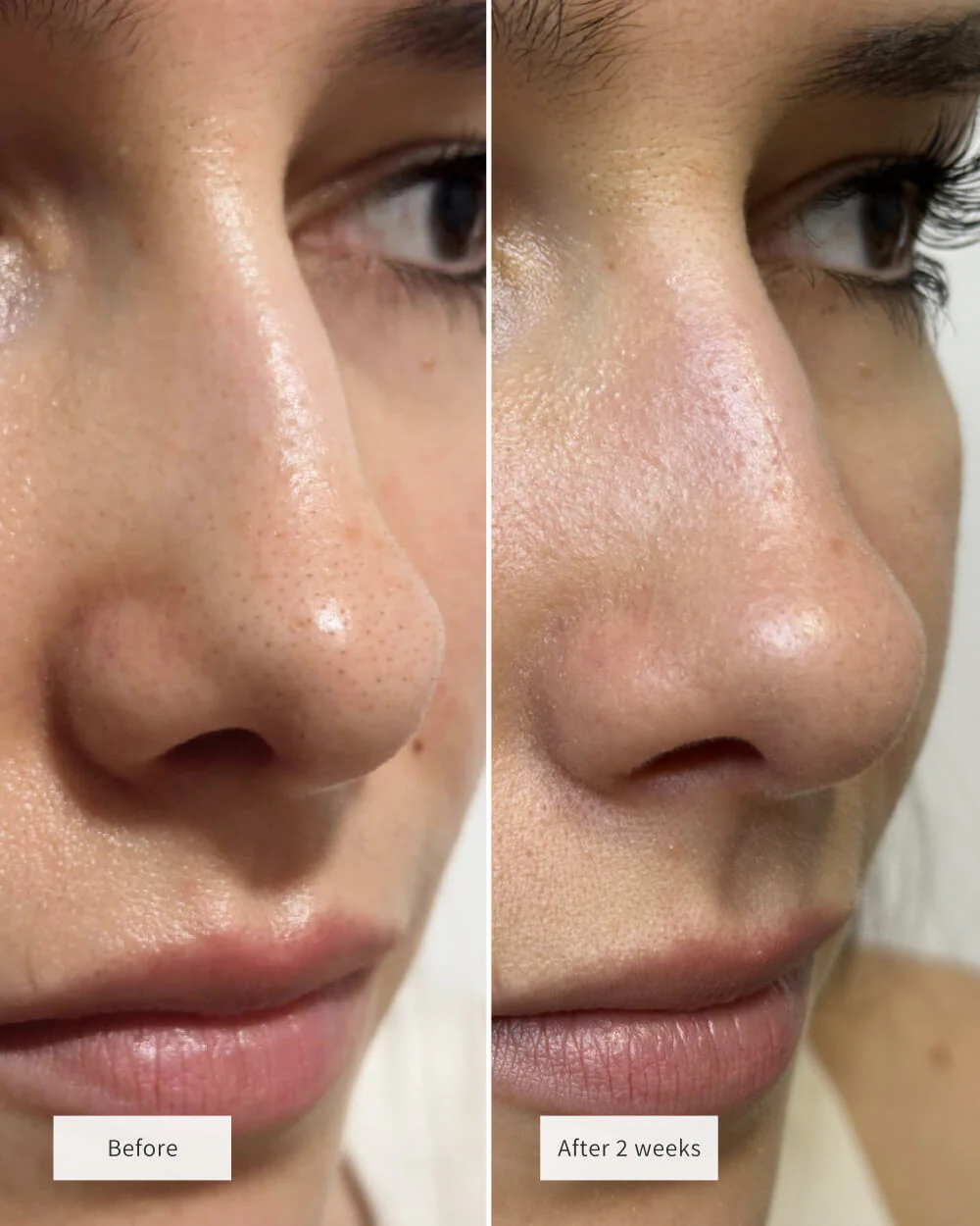 NOSE PATCHES - Image 7